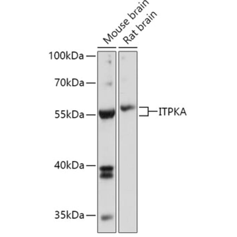 Western Blot - Anti-ITPKA Antibody (A306642) - Antibodies.com