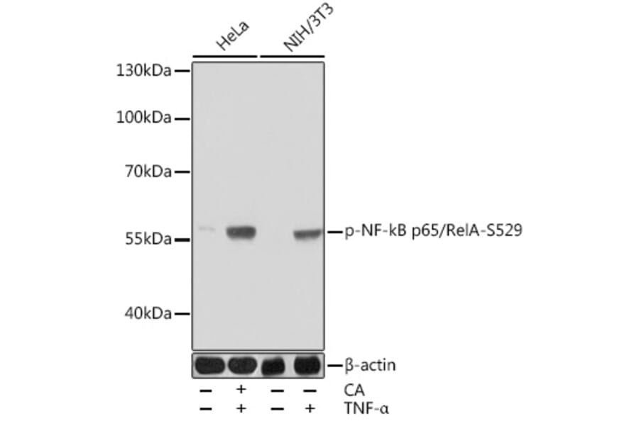 Western Blot - Anti-NF-kB p65 (phospho Ser529) Antibody (A306643) - Antibodies.com
