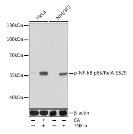 Western Blot - Anti-NF-kB p65 (phospho Ser529) Antibody (A306643) - Antibodies.com