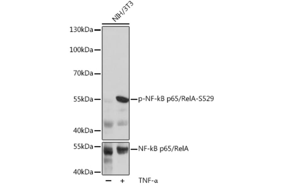 Western Blot - Anti-NF-kB p65 (phospho Ser529) Antibody (A306643) - Antibodies.com
