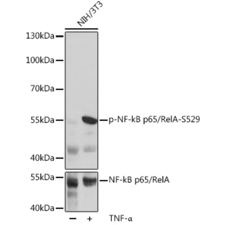 Western Blot - Anti-NF-kB p65 (phospho Ser529) Antibody (A306643) - Antibodies.com