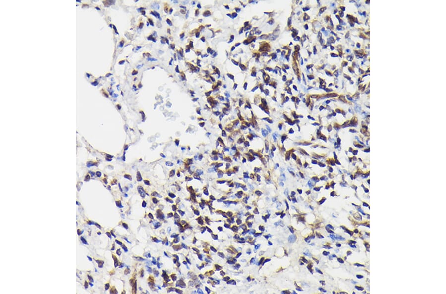Immunohistochemistry - Anti-NF-kB p65 (phospho Ser529) Antibody (A306643) - Antibodies.com