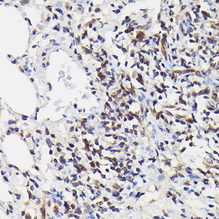 Immunohistochemistry - Anti-NF-kB p65 (phospho Ser529) Antibody (A306643) - Antibodies.com