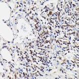 Immunohistochemistry - Anti-NF-kB p65 (phospho Ser529) Antibody (A306643) - Antibodies.com