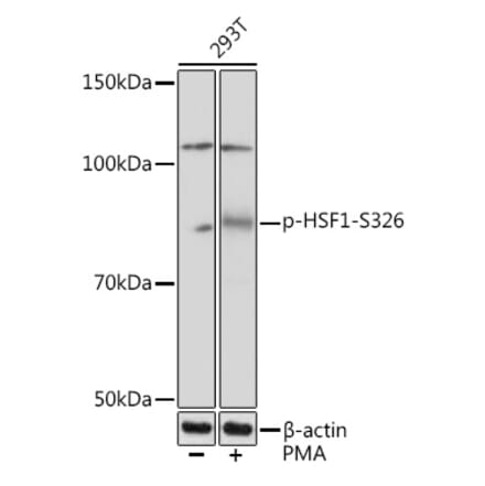 Western Blot - Anti-HSF1 (phospho Ser326) Antibody [ARC1601] (A306644) - Antibodies.com