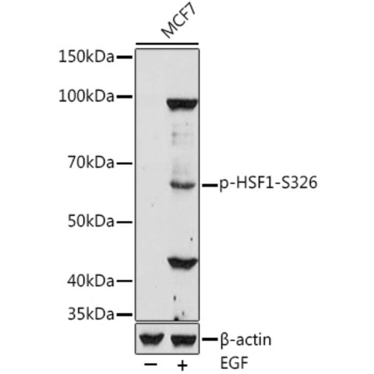 Western Blot - Anti-HSF1 (phospho Ser326) Antibody (A306645) - Antibodies.com