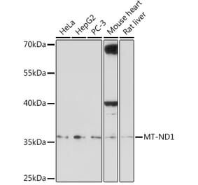 Western Blot - Anti-MT-ND1 Antibody (A306646) - Antibodies.com