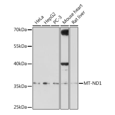 Western Blot - Anti-MT-ND1 Antibody (A306646) - Antibodies.com