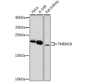 Western Blot - Anti-Tmem18 Antibody (A306647) - Antibodies.com