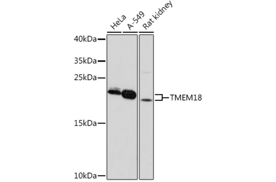 Western Blot - Anti-Tmem18 Antibody (A306647) - Antibodies.com