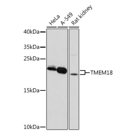 Western Blot - Anti-Tmem18 Antibody (A306647) - Antibodies.com