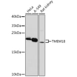 Western Blot - Anti-Tmem18 Antibody (A306647) - Antibodies.com