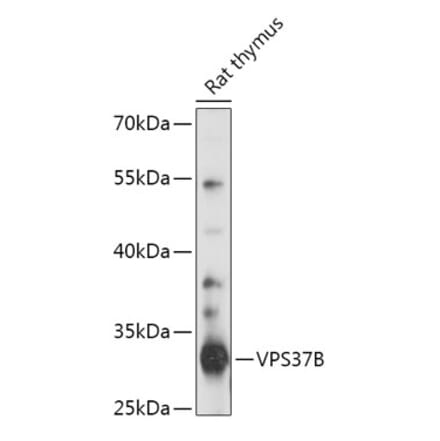 Western Blot - Anti-VPS37B Antibody (A306650) - Antibodies.com