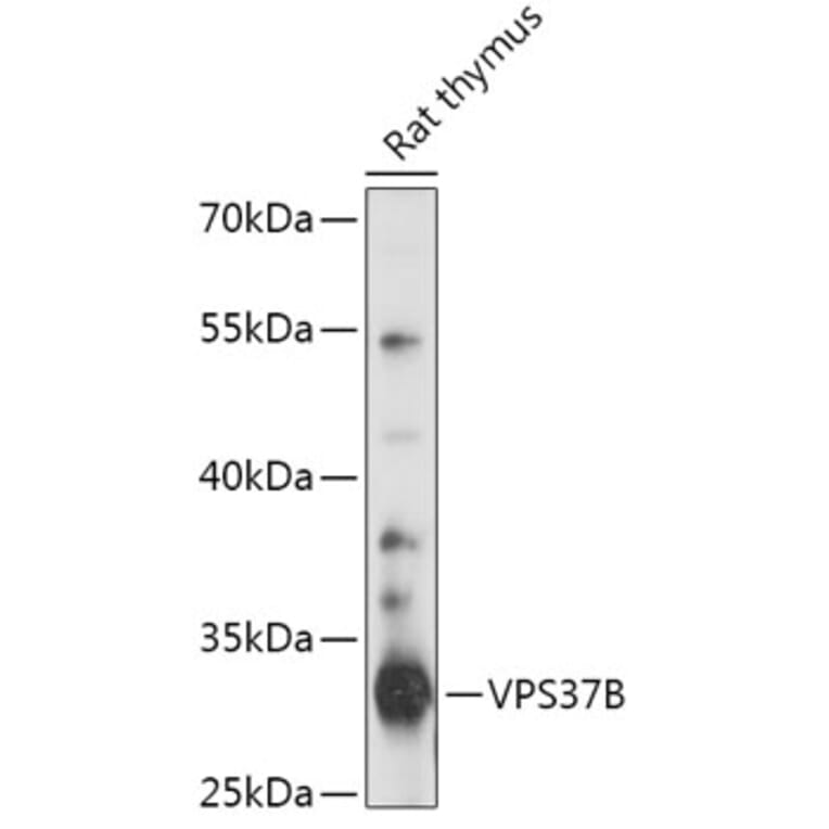 Western Blot - Anti-VPS37B Antibody (A306650) - Antibodies.com