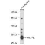 Western Blot - Anti-VPS37B Antibody (A306650) - Antibodies.com