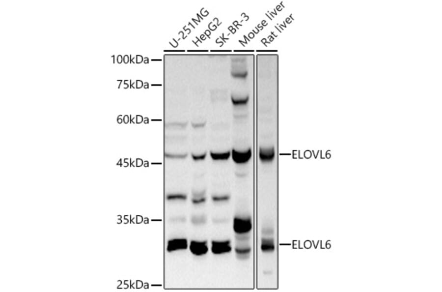 Western Blot - Anti-ELOVL6/LCE Antibody (A306651) - Antibodies.com