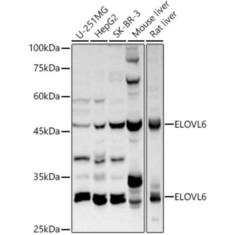 Western Blot - Anti-ELOVL6/LCE Antibody (A306651) - Antibodies.com