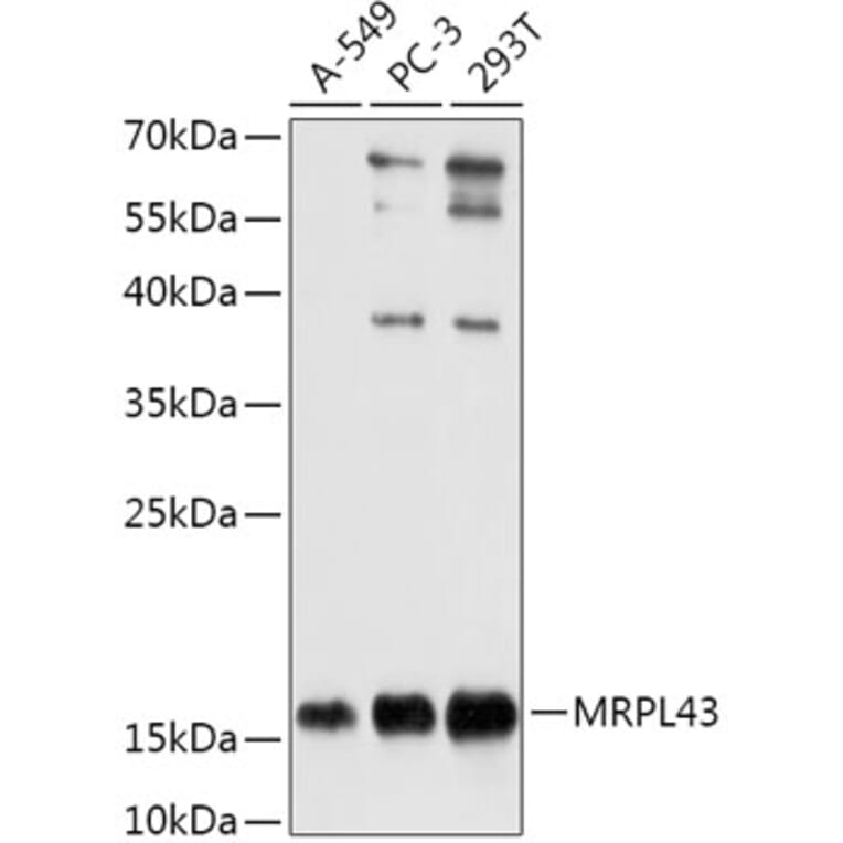 Western Blot - Anti-MRPL43 Antibody (A306652) - Antibodies.com