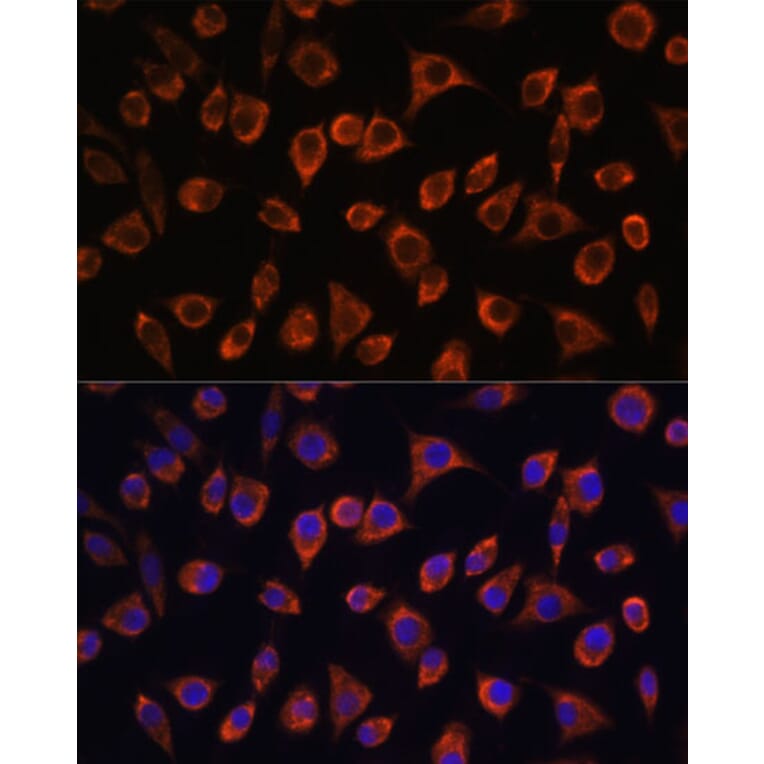 Immunofluorescence - Anti-MRPL43 Antibody (A306652) - Antibodies.com