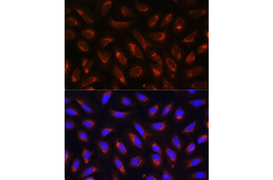 Immunofluorescence - Anti-MRPL43 Antibody (A306652) - Antibodies.com