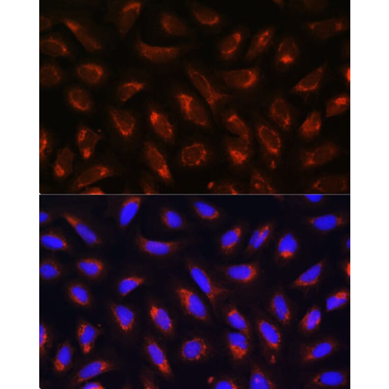 Immunofluorescence - Anti-MRPL43 Antibody (A306652) - Antibodies.com