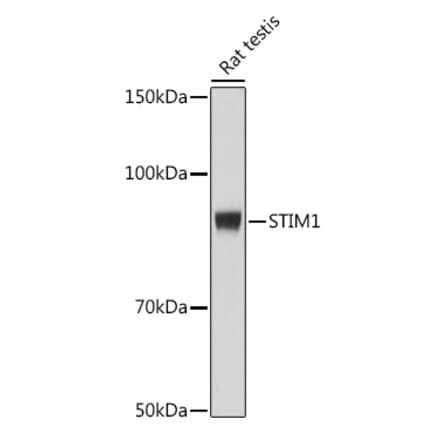 Western Blot - Anti-Stromal interaction molecule 1 Antibody [ARC1738] (A306653) - Antibodies.com