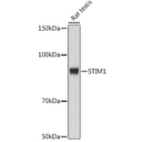 Western Blot - Anti-Stromal interaction molecule 1 Antibody [ARC1738] (A306653) - Antibodies.com