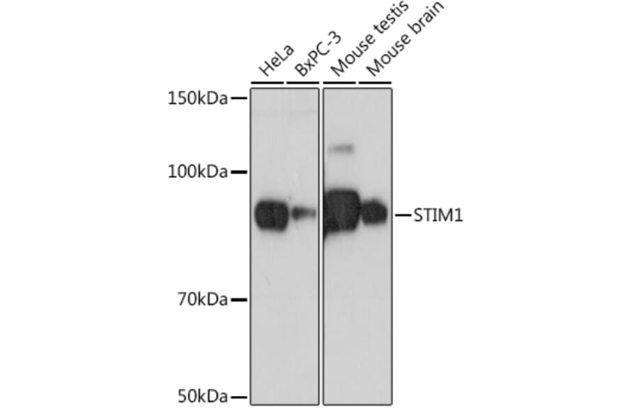 Western Blot - Anti-Stromal interaction molecule 1 Antibody [ARC1738] (A306653) - Antibodies.com