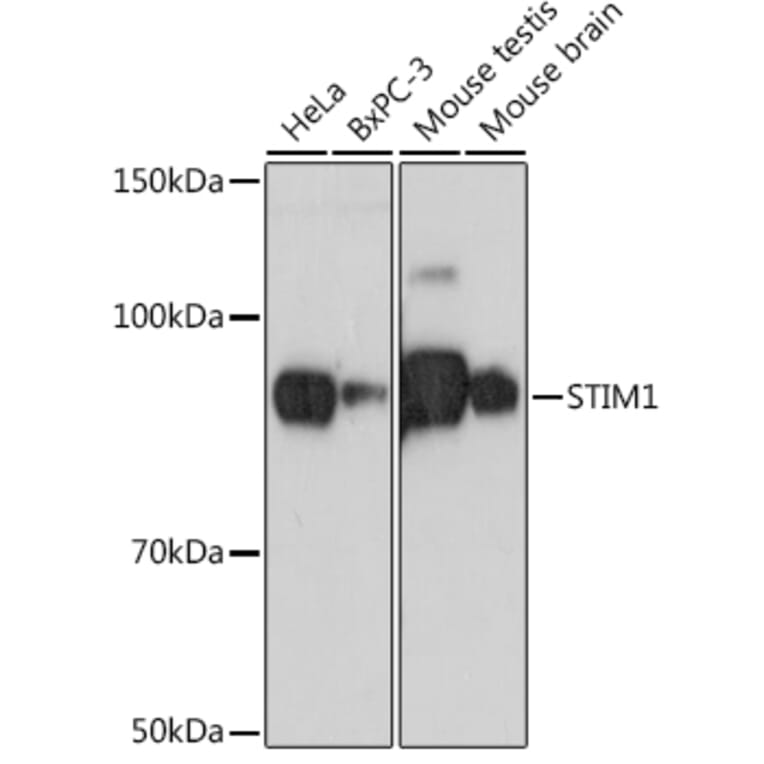 Western Blot - Anti-Stromal interaction molecule 1 Antibody [ARC1738] (A306653) - Antibodies.com