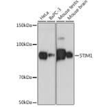 Western Blot - Anti-Stromal interaction molecule 1 Antibody [ARC1738] (A306653) - Antibodies.com