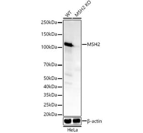 Western Blot - Anti-MSH2 Antibody [ARC55799] (A306655) - Antibodies.com