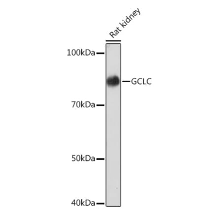 Western Blot - Anti-GCLC Antibody [ARC1065] (A306657) - Antibodies.com