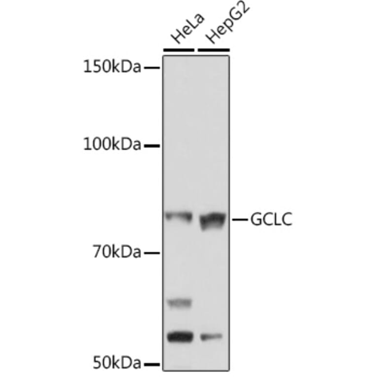 Western Blot - Anti-GCLC Antibody [ARC1065] (A306657) - Antibodies.com