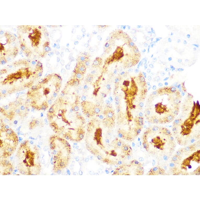 Immunohistochemistry - Anti-GCLC Antibody [ARC1065] (A306657) - Antibodies.com