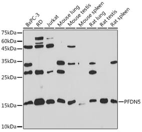 Western Blot - Anti-PFDN5 Antibody [ARC2111] (A306658) - Antibodies.com