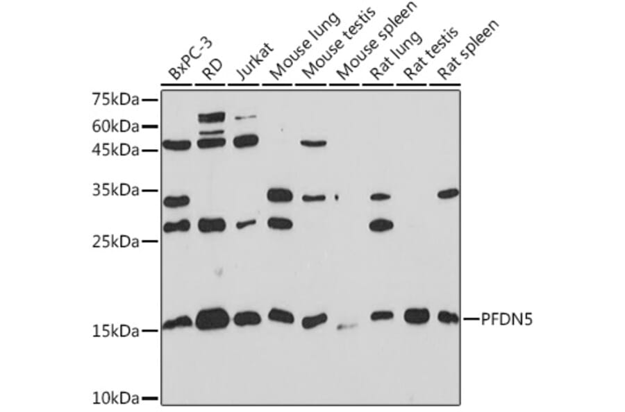 Western Blot - Anti-PFDN5 Antibody [ARC2111] (A306658) - Antibodies.com