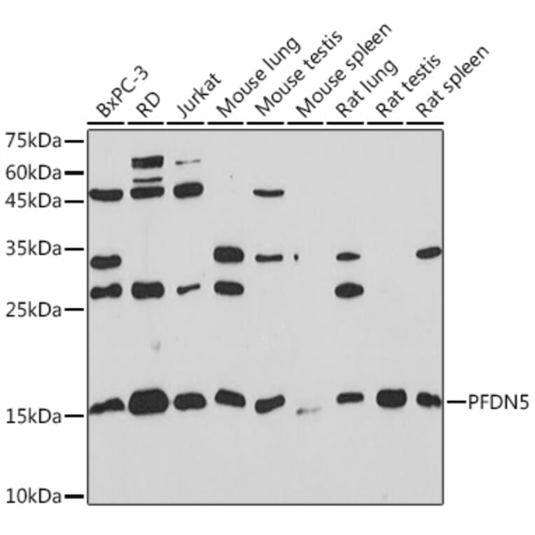 Western Blot - Anti-PFDN5 Antibody [ARC2111] (A306658) - Antibodies.com