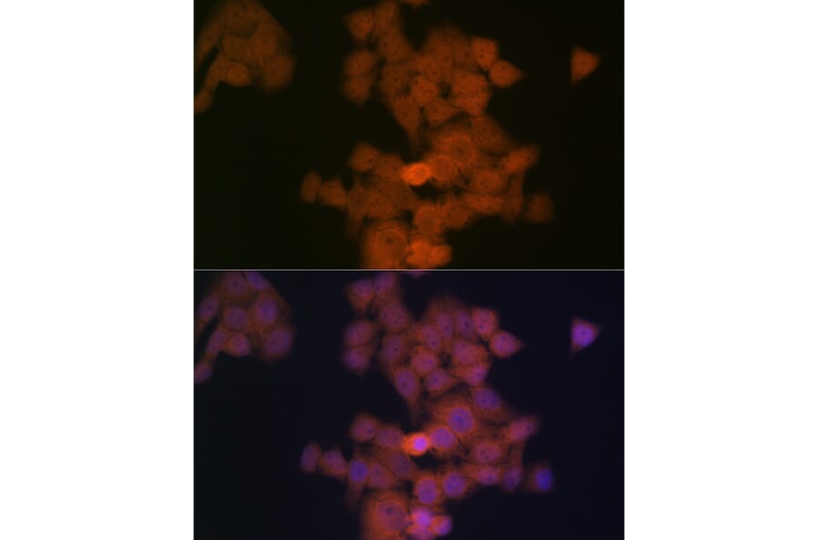 Immunofluorescence - Anti-PFDN5 Antibody [ARC2111] (A306658) - Antibodies.com