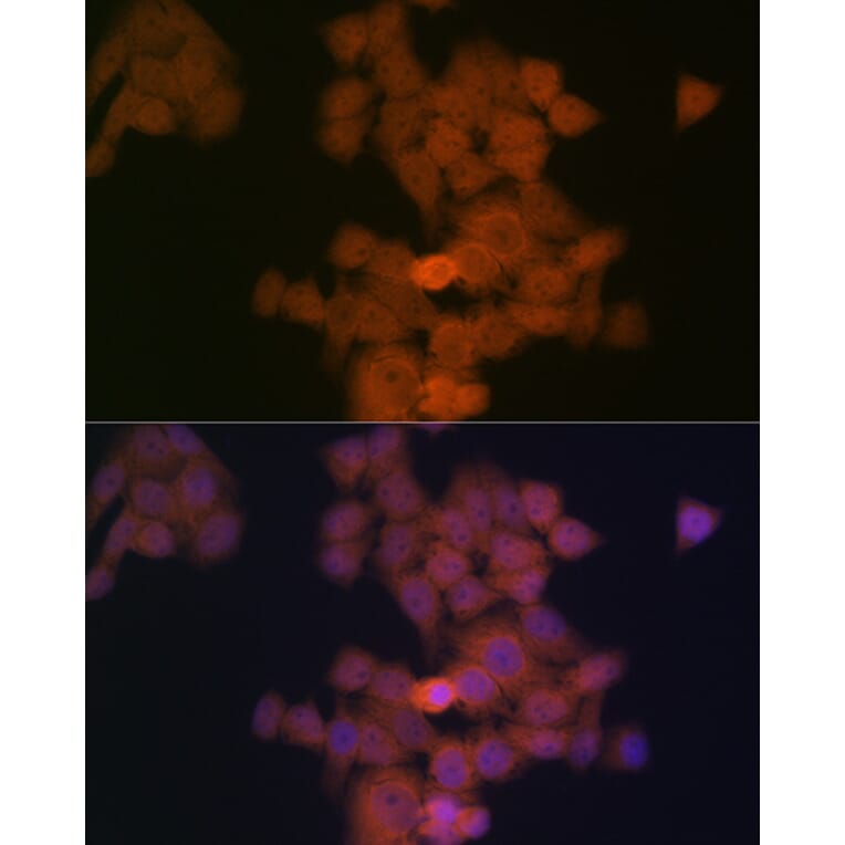 Immunofluorescence - Anti-PFDN5 Antibody [ARC2111] (A306658) - Antibodies.com