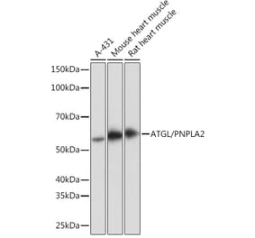 Western Blot - Anti-Adipose Triglyceride Lipase Antibody [ARC1192] (A306659) - Antibodies.com