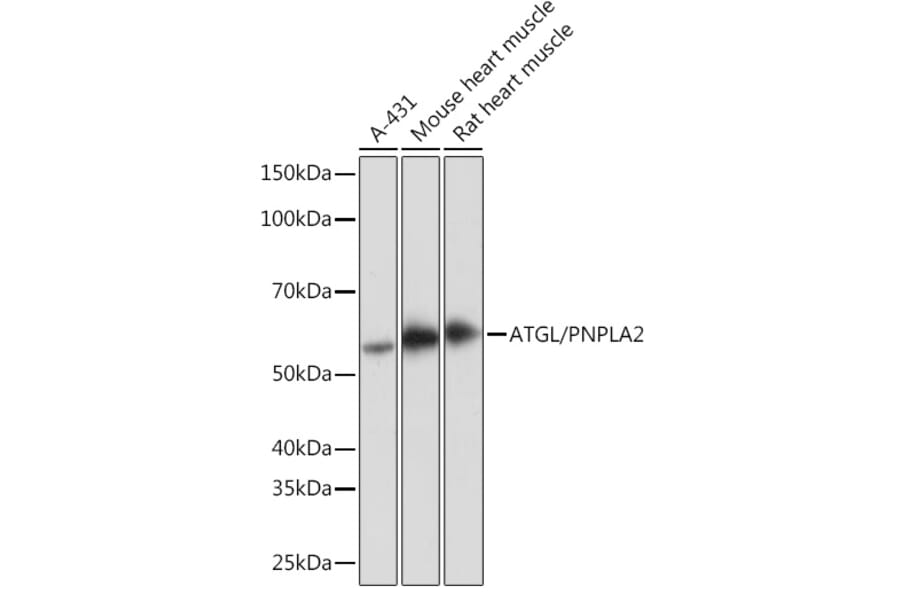 Western Blot - Anti-Adipose Triglyceride Lipase Antibody [ARC1192] (A306659) - Antibodies.com