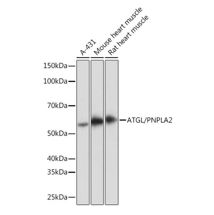 Western Blot - Anti-Adipose Triglyceride Lipase Antibody [ARC1192] (A306659) - Antibodies.com