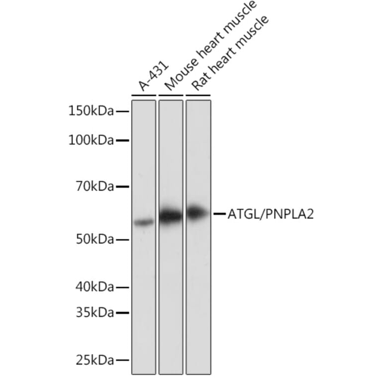 Western Blot - Anti-Adipose Triglyceride Lipase Antibody [ARC1192] (A306659) - Antibodies.com