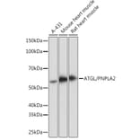 Western Blot - Anti-Adipose Triglyceride Lipase Antibody [ARC1192] (A306659) - Antibodies.com