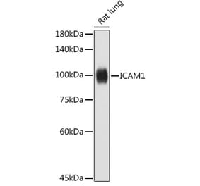 Western Blot - Anti-ICAM1 Antibody (A306660) - Antibodies.com