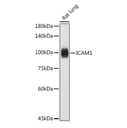 Western Blot - Anti-ICAM1 Antibody (A306660) - Antibodies.com