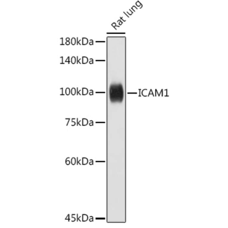 Western Blot - Anti-ICAM1 Antibody (A306660) - Antibodies.com