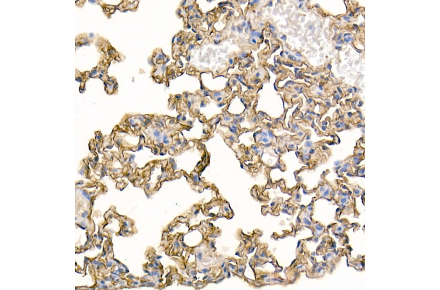 Immunohistochemistry - Anti-ICAM1 Antibody (A306660) - Antibodies.com