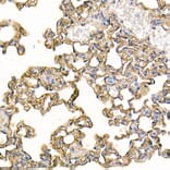 Immunohistochemistry - Anti-ICAM1 Antibody (A306660) - Antibodies.com