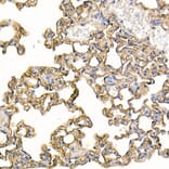 Immunohistochemistry - Anti-ICAM1 Antibody (A306660) - Antibodies.com